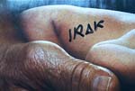 IRAK